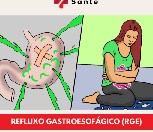 Refluxo Gastroesofágico (RGE)